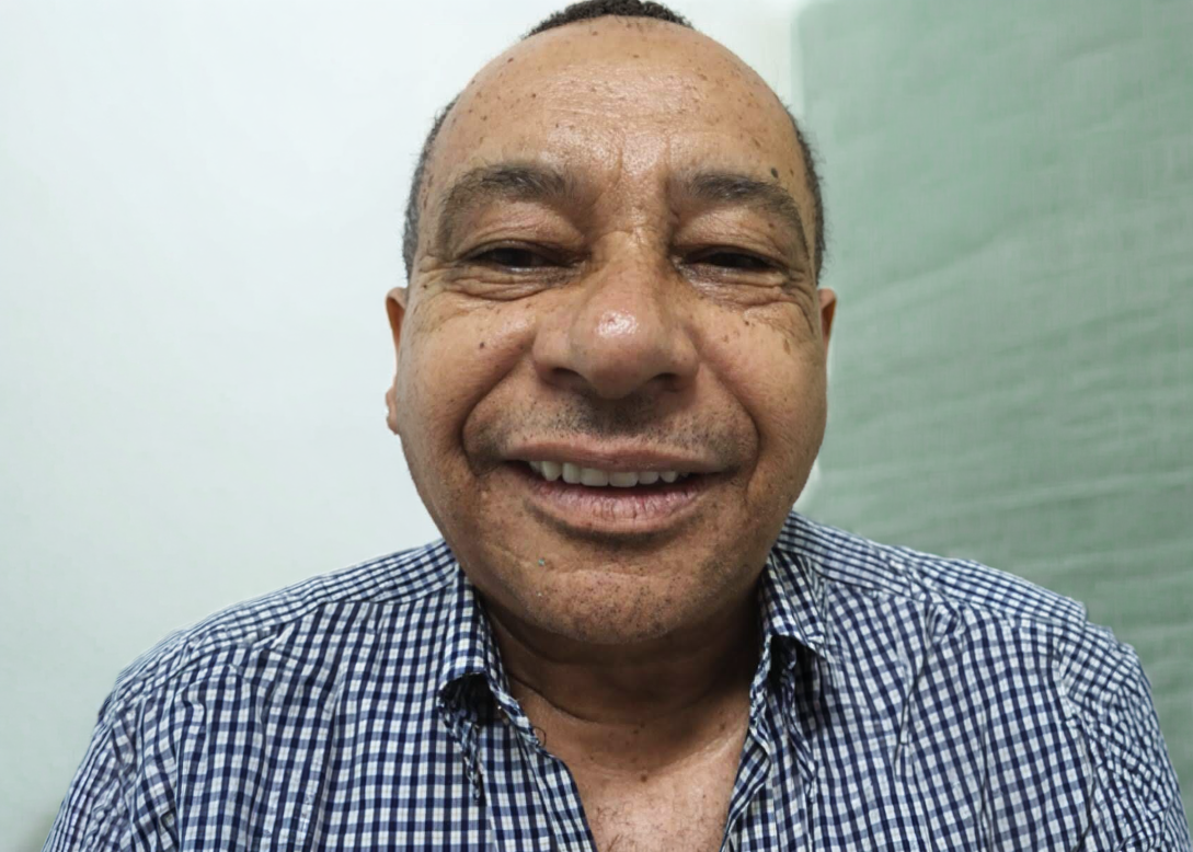 Dentes reabilitados após prótese